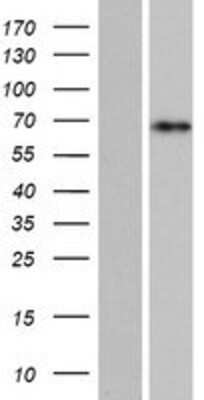 Western Blot: C15orf52 Overexpression Lysate (Adult Normal) [NBP2-04496] Left-Empty vector transfected control cell lysate (HEK293 cell lysate); Right -Over-expression Lysate for C15orf52.