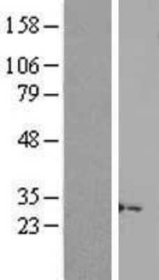 Western Blot LINC02694 Overexpression Lysate