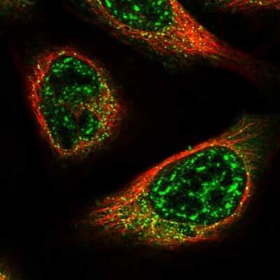 Immunocytochemistry/Immunofluorescence: C15orf57 Antibody [NBP1-91218] - Immunofluorescent staining of human cell line U-2 OS shows localization to nuclear speckles & vesicles.