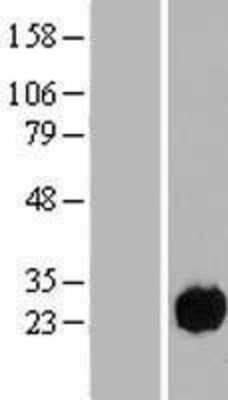 Western Blot: C15orf57 Overexpression Lysate (Adult Normal) [NBP2-09275] Left-Empty vector transfected control cell lysate (HEK293 cell lysate); Right -Over-expression Lysate for C15orf57.