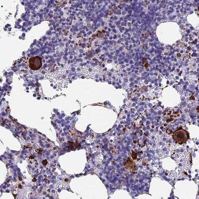 Immunohistochemistry-Paraffin: C15orf59 Antibody [NBP1-93545] - Staining of human bone marrow shows strong cytoplasmic positivity in megakaryocytes.