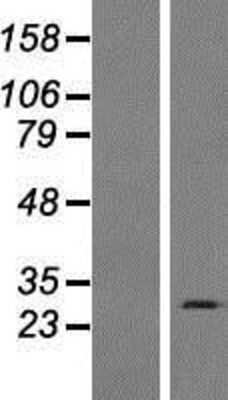 Western Blot: C15orf59 Overexpression Lysate (Adult Normal) [NBP2-08580] Left-Empty vector transfected control cell lysate (HEK293 cell lysate); Right -Over-expression Lysate for C15orf59.