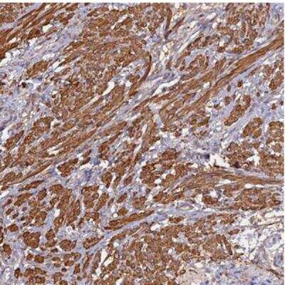 Immunohistochemistry: C16orf29 Antibody [NBP2-30849] - Staining of human smooth muscle shows strong cytoplasmic positivity in smooth muscle cells.