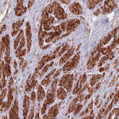 Immunohistochemistry: C16orf29 Antibody [NBP2-30875] - Staining of human smooth muscle shows strong cytoplasmic positivity.