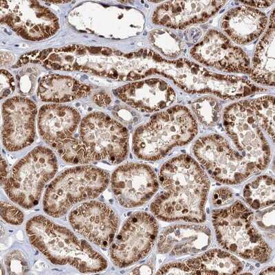 Immunohistochemistry-Paraffin: C16orf45 Antibody [NBP1-81996] - Staining of human kidney shows strong cytoplasmic and nuclear positivity in renal tubules.