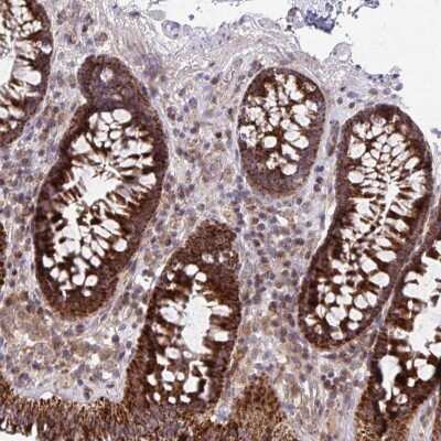 Immunohistochemistry: C16orf54 Antibody [NBP2-32553] - Staining of human colon shows strong cytoplasmic positivity in glandular cells.