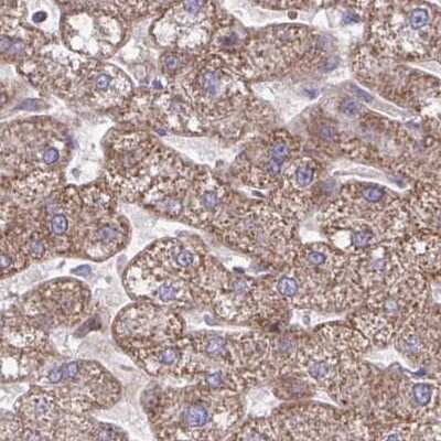 Immunohistochemistry: C16orf54 Antibody [NBP2-32553] - Staining of liver.