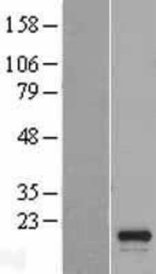Western Blot: C16orf55 Overexpression Lysate (Adult Normal) [NBL1-08217] Left-Empty vector transfected control cell lysate (HEK293 cell lysate); Right -Over-expression Lysate for C16orf55.