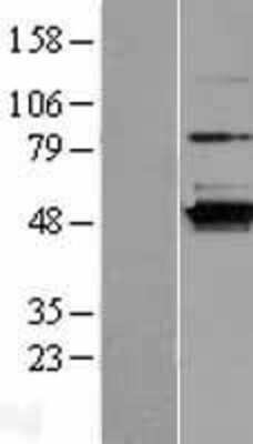 Western Blot: C16orf58 Overexpression Lysate (Adult Normal) [NBL1-08219] Left-Empty vector transfected control cell lysate (HEK293 cell lysate); Right -Over-expression Lysate for C16orf58.