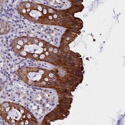Immunohistochemistry-Paraffin: C16orf62 Antibody [NBP1-82744] - Staining of human rectum shows strong cytoplasmic and membranous positivity in glandular cells.