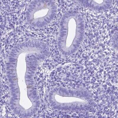 Immunohistochemistry-Paraffin: C16orf71 Antibody [NBP2-48935] - Staining of human endometrium shows low expression as expected.