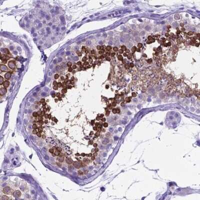 Immunohistochemistry-Paraffin: C16orf71 Antibody [NBP2-48935] - Staining of human testis shows high expression.