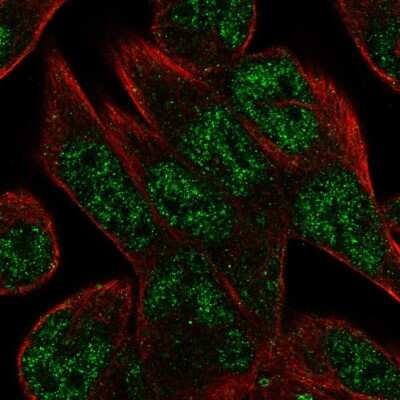 Immunocytochemistry/Immunofluorescence: C16orf72 Antibody [NBP2-56955] - Staining of human cell line RH-30 shows localization to nucleoplasm.