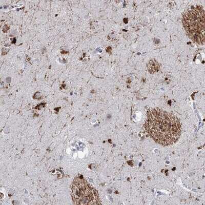 Immunohistochemistry-Paraffin: C16orf72 Antibody [NBP1-93773] - Staining of human lateral ventricle shows strong cytoplasmic positivity in neuronal cells.