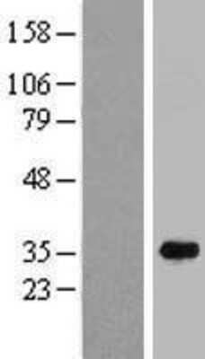Western Blot C16orf72 Overexpression Lysate