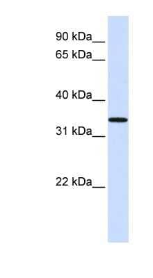 Western Blot: C16orf78 Antibody [NBP1-56418] - Human Lung lysate, concentration 0.2-1 ug/ml.