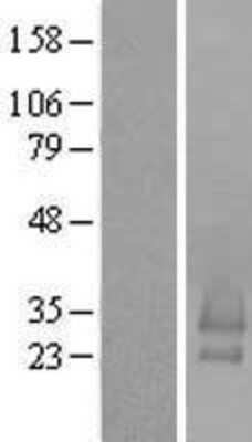 Western Blot BRICD5 Overexpression Lysate