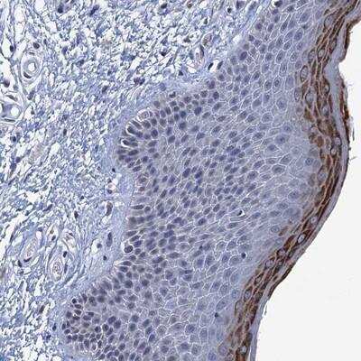 Immunohistochemistry: C16orf87 Antibody [NBP1-86230] - Staining of human vulva/anal skin shows strong dot like cytoplasmic positivity in superficial layer of epidermal cells.