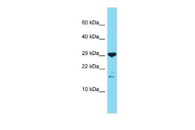 Western Blot: C16orf87 Antibody [NBP2-82851] - Host: Rabbit. Target Name: C16orf87. Sample Type: OVCAR-3 Whole Cell lysates. Antibody Dilution: 1.0ug/ml