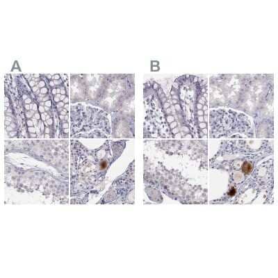 Immunohistochemistry-Paraffin C16orf89 Antibody