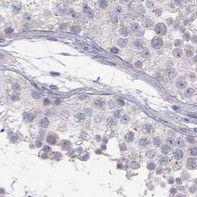 Immunohistochemistry-Paraffin C16orf89 Antibody