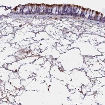 Immunohistochemistry-Paraffin: C16orf93 Antibody [NBP2-30950] - Staining of human nasopharynx shows strong positivity in respiratory epithelial cells.