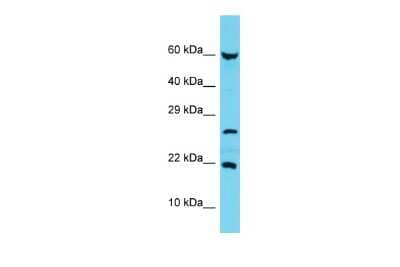 Western Blot: C17orf102 Antibody [NBP3-10759] - Western blot analysis of C17orf102 in MCF7 Whole Cell lysates. Antibody dilution at 1.0ug/ml