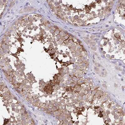 Immunohistochemistry-Paraffin: C17orf105 Antibody [NBP2-38687] - Staining of human testis shows distinct cytoplasmic positivity in subsets of cells.