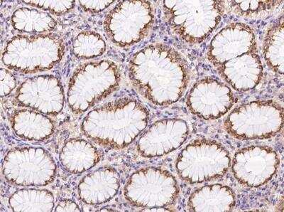 Immunohistochemistry-Paraffin: C17orf107 Antibody [NBP3-05905] - Staining of human C17orf107 in human stomach with rabbit polyclonal antibody at 1:100 dilution.