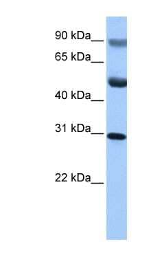 Western Blot GID4 Antibody