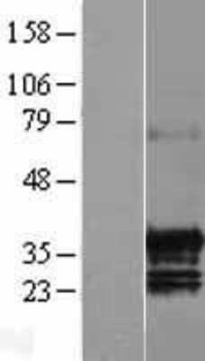 Western Blot: C17orf39 Overexpression Lysate (Adult Normal) [NBL1-08233] Left-Empty vector transfected control cell lysate (HEK293 cell lysate); Right -Over-expression Lysate for C17orf39.