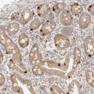 Immunohistochemistry-Paraffin: C17orf47 Antibody [NBP1-93787] - Staining of human duodenum shows strong cytoplasmic positivity in a subset of glandular cells.