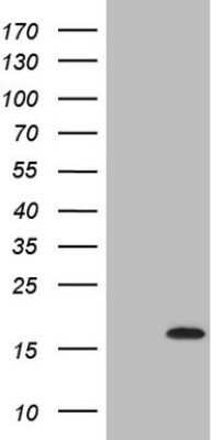 Western Blot: C17orf58 Antibody (OTI6E9) - Azide and BSA Free [NBP2-72489] - Analysis of HEK293T cells were transfected with the pCMV6-ENTRY control (Left lane) or pCMV6-ENTRY C17orf58.