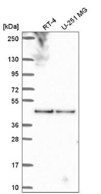 Western Blot: BORC6 Antibody [NBP2-56321] - Analysis in human cell line RT-4 and human cell line U-251 MG.
