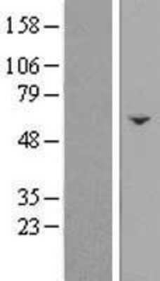 Western Blot: C17orf63 Overexpression Lysate (Adult Normal) [NBL1-08241] Left-Empty vector transfected control cell lysate (HEK293 cell lysate); Right -Over-expression Lysate for C17orf63.