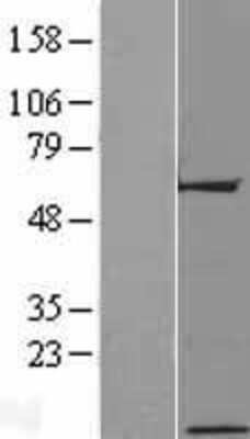 Western Blot: C17orf64 Overexpression Lysate (Adult Normal) [NBP2-04897] Left-Empty vector transfected control cell lysate (HEK293 cell lysate); Right -Over-expression Lysate for C17orf64.