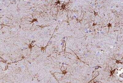 Immunohistochemistry-Paraffin: C17orf67 Antibody [NBP1-94155] - Staining of human caudate shows distinct positivity in astrocytes.