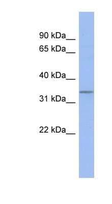 Western Blot: C17orf78 Antibody [NBP1-60078] - Titration: 0.2-1 ug/ml, Positive Control: Jurkat cell lysate.