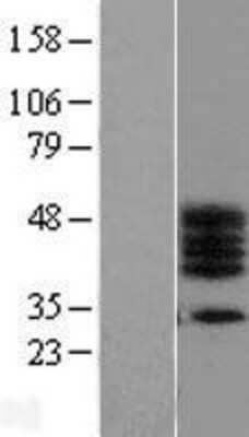 Western Blot: C17orf78 Overexpression Lysate (Adult Normal) [NBL1-08244] Left-Empty vector transfected control cell lysate (HEK293 cell lysate); Right -Over-expression Lysate for C17orf78.