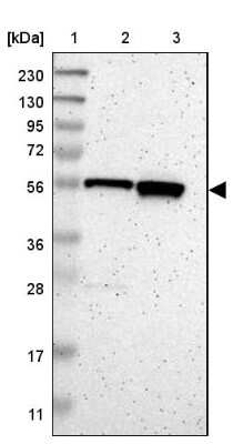 Western Blot: C17orf80 Antibody [NBP1-83637] - Lane 1: Marker [kDa] 230, 130, 95, 72, 56, 36, 28, 17, 11, Lane 2: Human cell line RT-4, Lane 3: Human cell line U-251MG sp