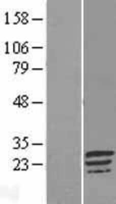 Western Blot: C17orf82 Overexpression Lysate (Adult Normal) [NBL1-08248] Left-Empty vector transfected control cell lysate (HEK293 cell lysate); Right -Over-expression Lysate for C17orf82.