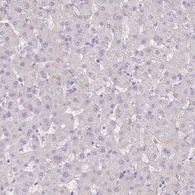 Immunohistochemistry-Paraffin: C17orf96 Antibody [NBP2-47535] - Staining of human liver shows low expression as expected.
