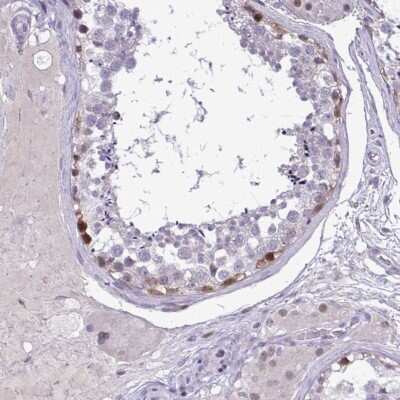 Immunohistochemistry-Paraffin: C17orf96 Antibody [NBP2-47535] - Staining of human testis shows high expression.