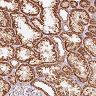 Immunohistochemistry C17orf98 Antibody - BSA Free