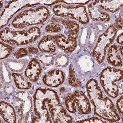 Immunohistochemistry: C18orf21 Antibody [NBP2-49514] - Staining of human kidney shows strong cytoplasmic positivity in cells in tubules.