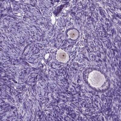 Immunohistochemistry-Paraffin: C18orf21 Antibody [NBP2-49449] - Staining of human ovary shows moderate nucleolar positivity in follicle cells.