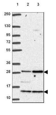 Western Blot: C18orf21 Antibody [NBP2-49449] - Lane 1: Marker [kDa] 250, 130, 95, 72, 55, 36, 28, 17, 10Lane 2: Human cell line RT-4Lane 3: Human cell line U-251 MG