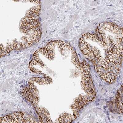 Immunohistochemistry: C18orf25 Antibody [NBP2-49000] - Staining of human prostate shows strong cytoplasmic positivity, seen with a granular pattern, in glandular cells.