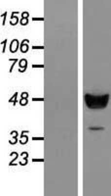 Western Blot: C18orf25 Overexpression Lysate (Adult Normal) [NBL1-08253] Left-Empty vector transfected control cell lysate (HEK293 cell lysate); Right -Over-expression Lysate for C18orf25.