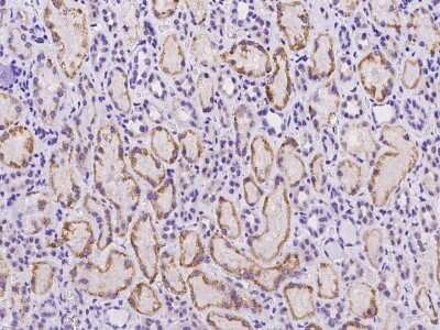 Immunohistochemistry-Paraffin C18orf32 Antibody - BSA Free
